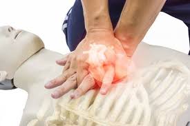 Suporte Básico de Vida em Adultos